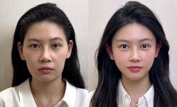 点击看大图 -Yestar艺星医疗美容医院