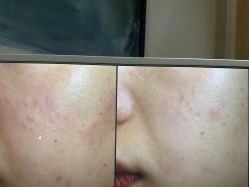 -苑苑vbeauty科技美容SPA