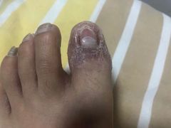 -Andrew指甲专科灰指甲·甲沟炎矫正·3D步态矫形鞋垫定制(上海法华镇路旗舰店)