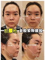 点击看大图 -靓芙泉·0感专研祛痘