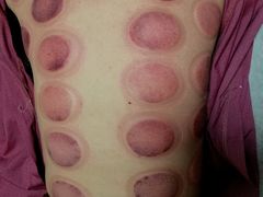 -感智盲人按摩·艾灸·肩颈SPA(岗厦店)