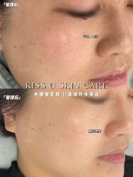 -KISS U 国际美学