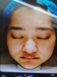 -武汉五洲整形外科医院