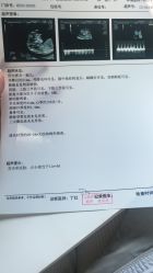 -上海百佳妇产医院