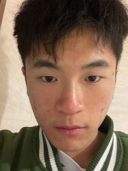 体验后-重庆军美医疗美容医院