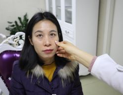 -天津健丽·去眼袋医疗美容机构