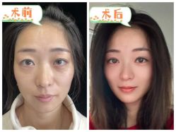 -素美医疗美容·西南眼鼻整形·修复基地