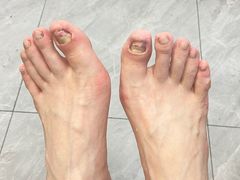 -世龙世家手足健康护理连锁(福田梅林路润裕花园店)