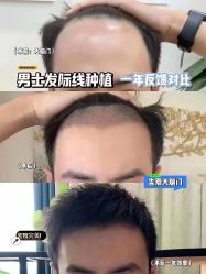 -木北造型