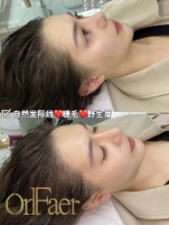 -OnFaer.纹眉半永久无创洗眉