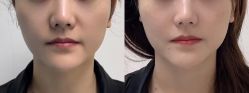-CMS西美斯·美式医疗美容