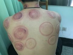 -孟氏拔罐(纬一路店)