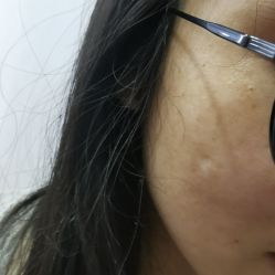 点击看大图 -广州美莱医疗美容医院