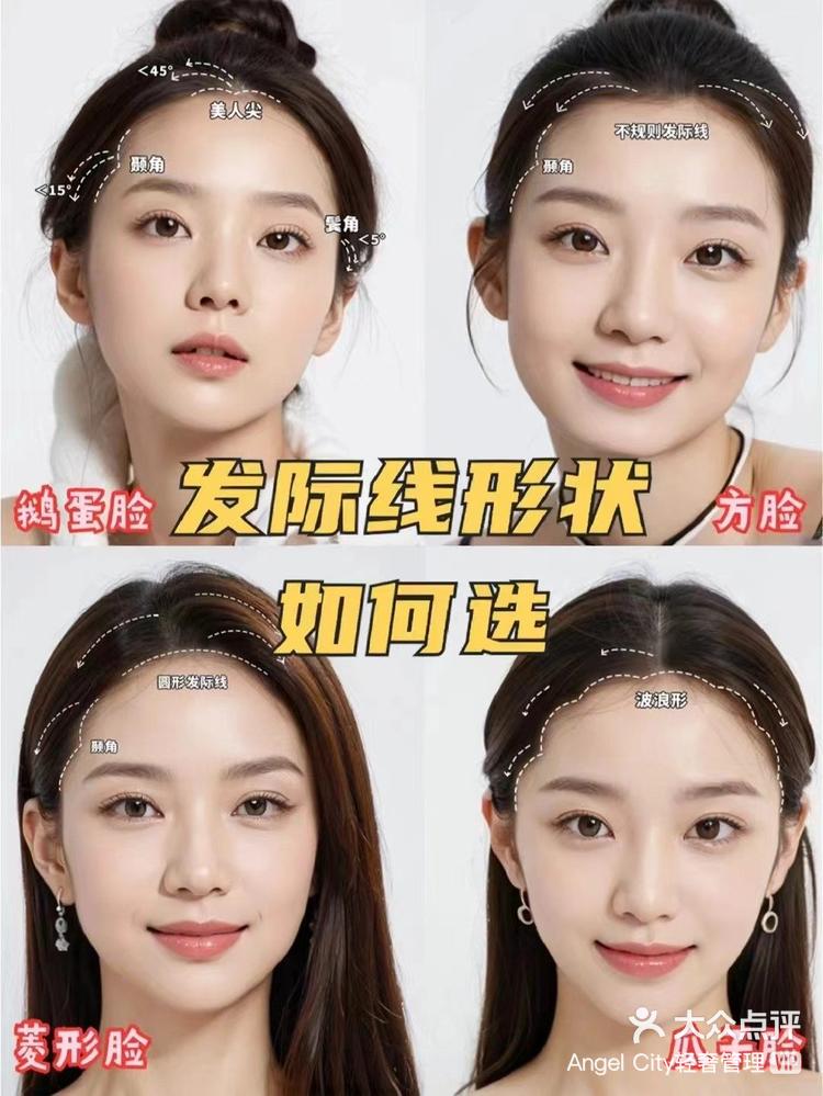 不同脸型适合的发际线形状: 鹅蛋脸:花瓣