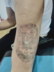 -英刺青 纹身 洗纹身