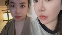 体验前-杭州米兰柏羽医疗美容医院