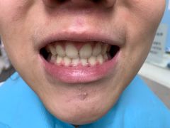 -北京大学口腔医院(第一门诊部)