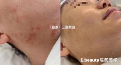 -E.beauty驻颜·痘敏肌调理中心