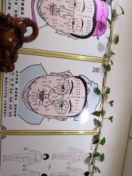 -北京美痣堂古方祛痣斑疣瘊
