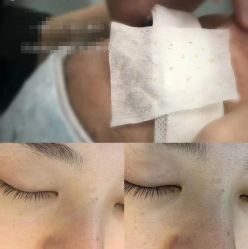 -蕾特恩专业祛痘·皮肤管理