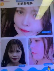 -成都西区医院整形美容