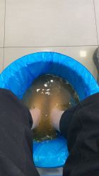 -德哥灰指甲脚气甲沟炎跖疣护理