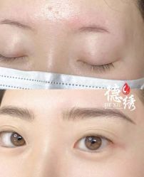 -德绣·机器野生眉发际线·美瞳线半永久