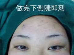 -苏州大学理想眼科医院