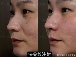 -北京米扬丽格医疗美容·联合丽格鼻整形中心