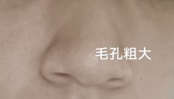 点击看大图 体验前-北京京通医院医疗美容