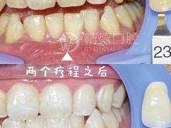 -精德口腔·种植修复·儿牙中心(财富中心店)