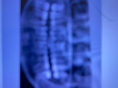 -土豆口腔(凤凰北总店)