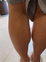 -Yestar杭州艺星医疗美容医院