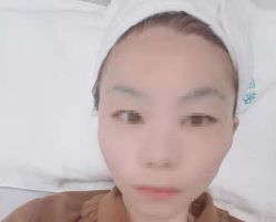 体验后-北京楚诺医疗美容