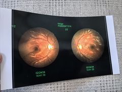 -天津大学爱尔眼科医院(天津院区)