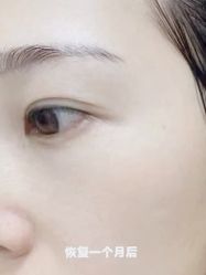 -伊丽莎白医疗美容