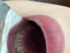 -宁波壹加壹口腔·矫正种植中心