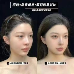 -媛音医美