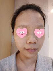 体验后-广州美莱医疗美容医院