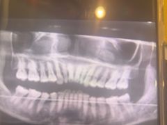 -土豆口腔(凤凰北总店)