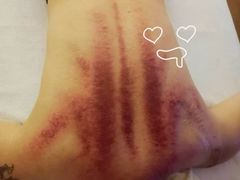 -善艾今生·推拿·艾灸·SPA(禾祥东路店)