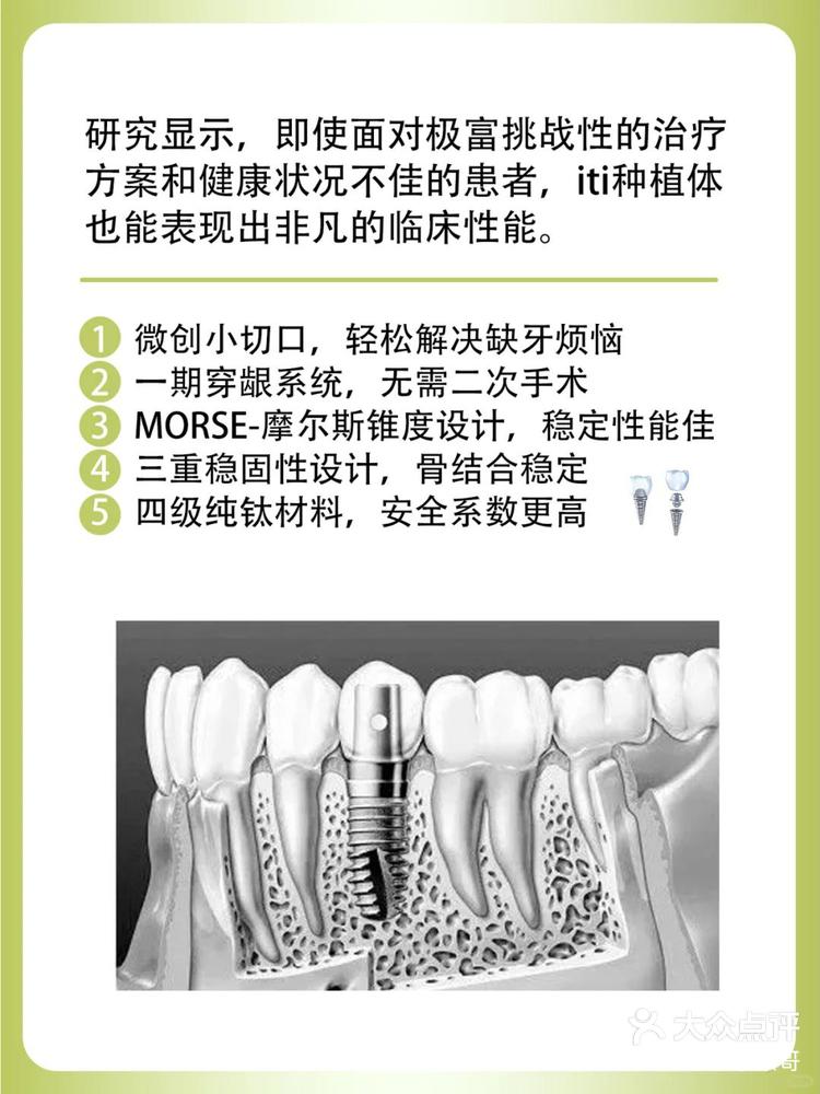 目前国际上公认的稳定的种植系统是瑞士iti种植体,是瑞士schroeder和