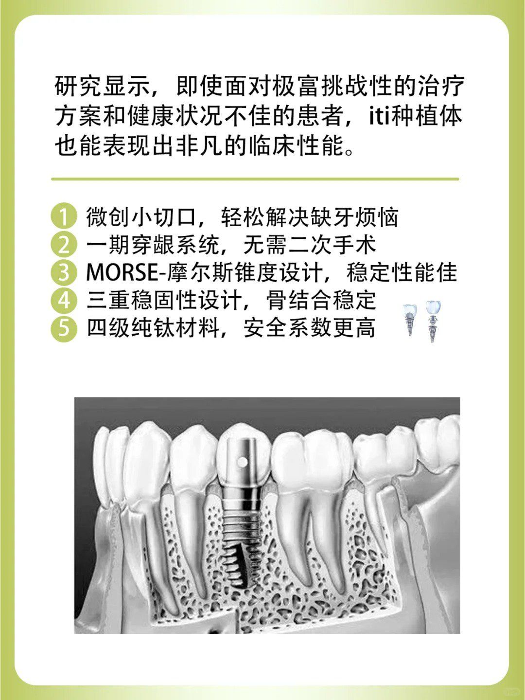 目前国际上公认的稳定的种植系统是瑞士iti种植体,是瑞士schroeder和