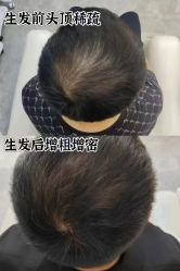 -诗碧曼养发