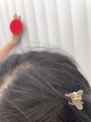 点击看大图 -熙朵美学植发连锁
