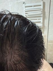 -熙朵美学植发·连锁品牌