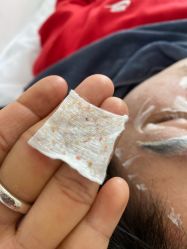 -瑶芳清颜草本祛痘