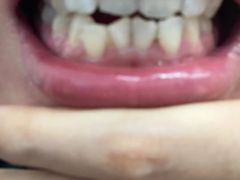 -微笑牙科口腔(三亚迎宾院区)