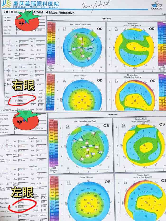 OD体育官方网站- OD体育APP下载- 世界杯指定投注平台视力验光单怎么看-有来医生