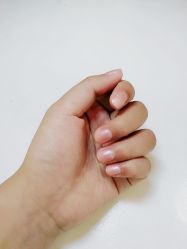 -初樱科技美学问题肌修复中心